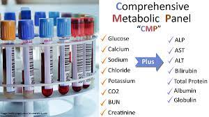 Comprehensive Metabolic Panel