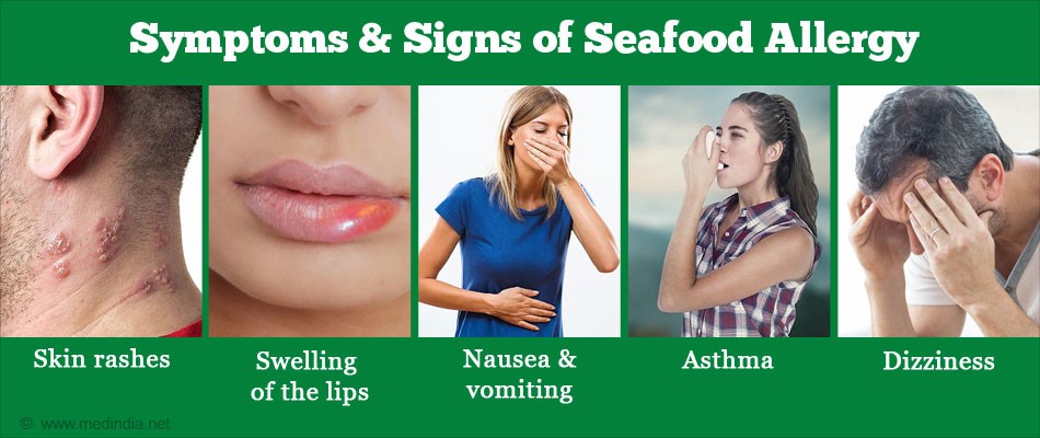 Seafood Allergy Panel