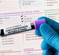 Comprehensive Metabolic Panel (CMP) For Men and Woman