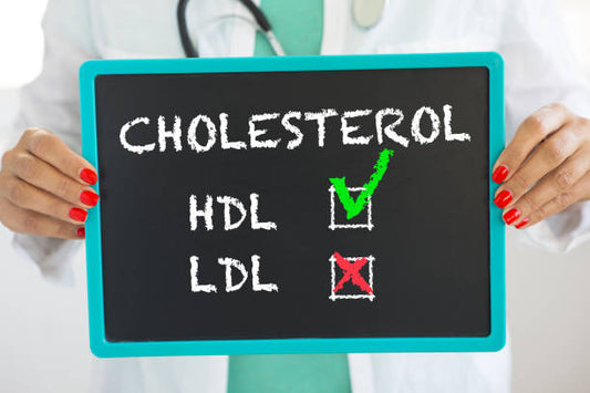 Cholesterol Panel