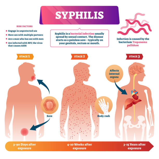 Syphilis with Confirmation