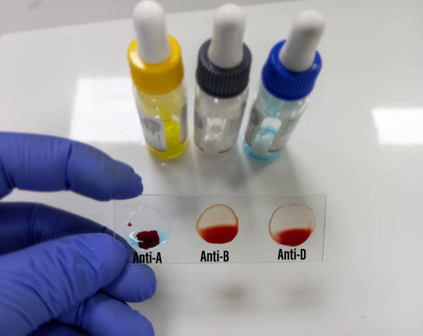 Blood Type (ABO, Rh)
