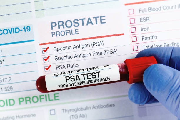 Prostate Screening (PSA)