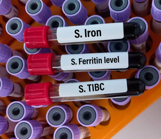 Iron, TIBC and Ferritin